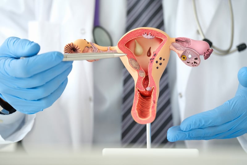 doctor shows female reproductive system